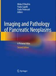 Imaging and Pathology of Pancreatic Neoplasms: A Pictorial Atlas, 2nd Edition