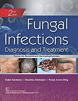 Fungal Infections Diagnosis and Treatment, 2nd edition