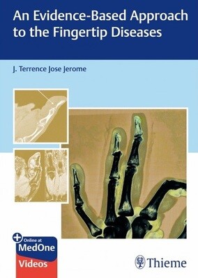 An Evidence-Based Approach To The Fingertip Diseases