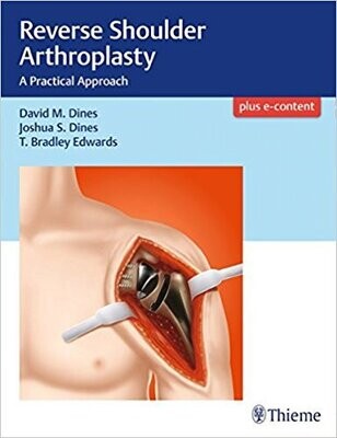 Reverse Shoulder Arthroplasty: A Practical Approach (EPUB)