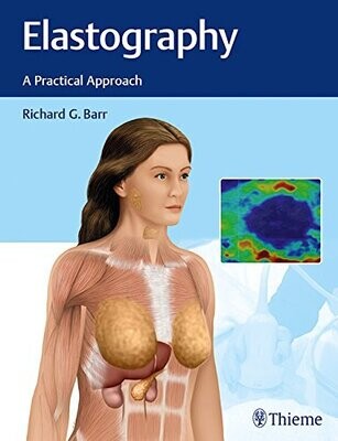Elastography: A Practical Approach (EPUB)