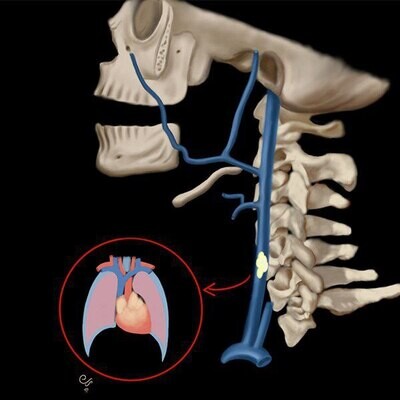 MRIOnline Emergency Series: Emergency Neuroimaging: Head, Neck &amp; Spine 2021 (CME VIDEOS)