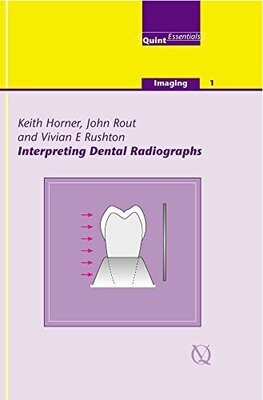 Interpreting Dental Radiographs (Imaging Vol. 1) (Quintessentials of Dental Practice) (Quintessentials: Imaging) (EPUB)