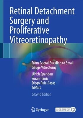 Retinal Detachment Surgery and Proliferative Vitreoretinopathy: From Scleral Buckling to Small Gauge Vitrectomy
2nd ed. 2022 Edition