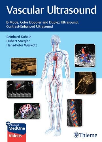 Vascular Ultrasound: B-Mode, Color Doppler and Duplex Ultrasound, Contrast-Enhanced Ultrasound
1st Edition
