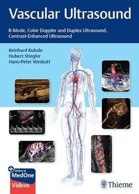 Vascular Ultrasound: B-Mode, Color Doppler and Duplex Ultrasound, Contrast-Enhanced Ultrasound
1st Edition