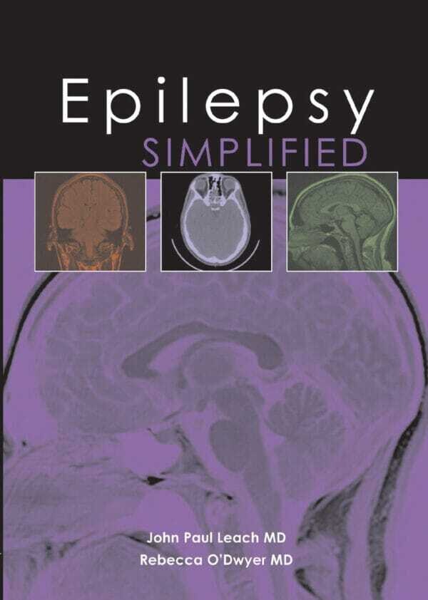 Epilepsy Simplified (Simplified (TFM Publishing))
1st Edition