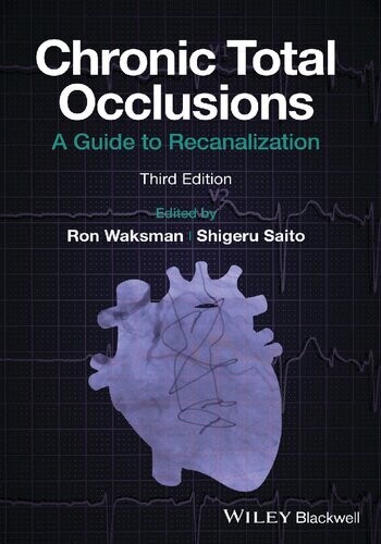 Chronic Total Occlusions: A Guide to Recanalization
1st Edition