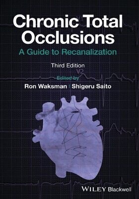 Chronic Total Occlusions: A Guide to Recanalization
1st Edition