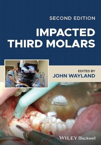 Impacted Third Molars