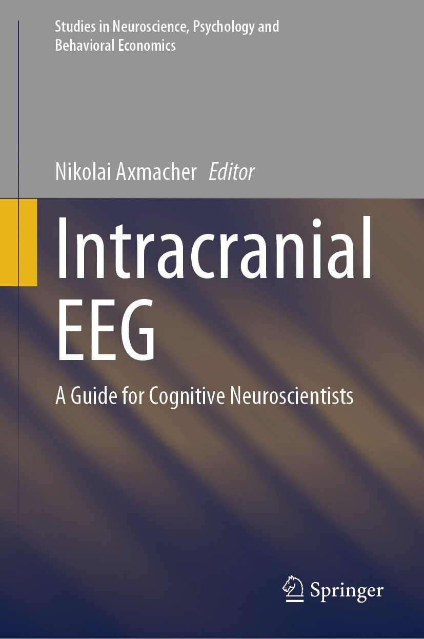 Intracranial EEG: A Guide for Cognitive Neuroscientists