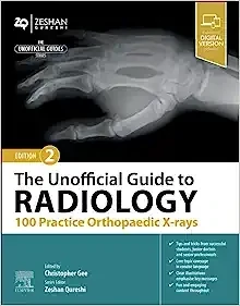 The Unofficial Guide to Radiology: 100 Practice Orthopaedic X-rays, 2nd edition (EPUB)