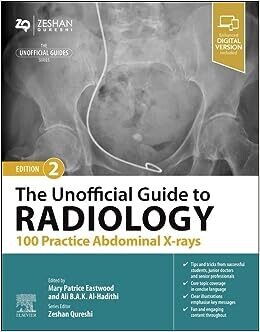 The Unofficial Guide to Radiology: 100 Practice Abdominal X-rays, 2nd edition