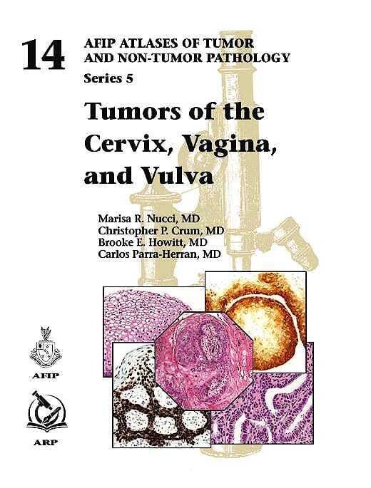 Tumors of the Cervix, Vagina, and Vulva (AFIP Atlas of Tumor and Non-Tumor Pathology, Series 5)