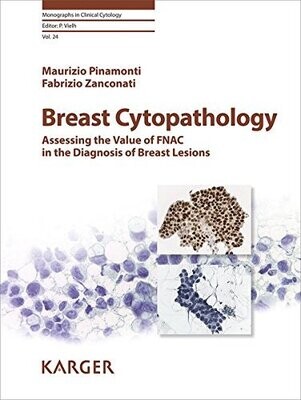 Breast Cytopathology: Assessing the Value of Fnac in the Diagnosis of Breast Lesions (Monographs in Clinical Cytology)