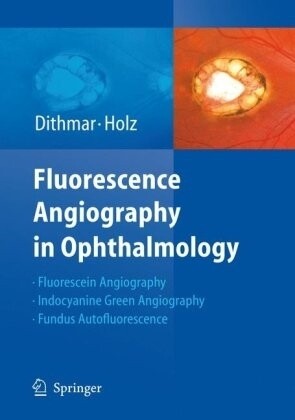 Fluorescence angiography in ophthalmology
