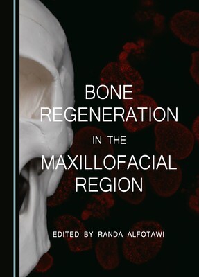 Bone Regeneration in the Maxillofacial Region