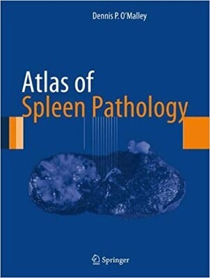 Atlas of Spleen Pathology (Atlas of Anatomic Pathology)