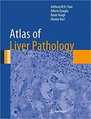 Atlas of Liver Pathology (Atlas of Anatomic Pathology)
2014th Edition