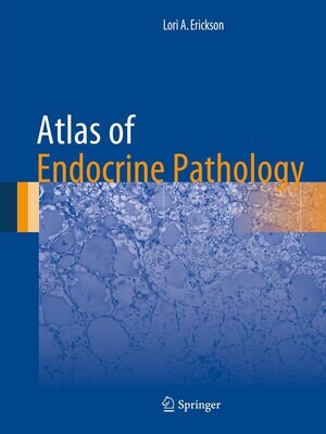 Atlas of Endocrine Pathology (Atlas of Anatomic Pathology)
2014th Edition