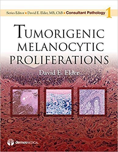 Consultant Pathology: Tumorigenic Melanocytic Proliferations
1st Edition