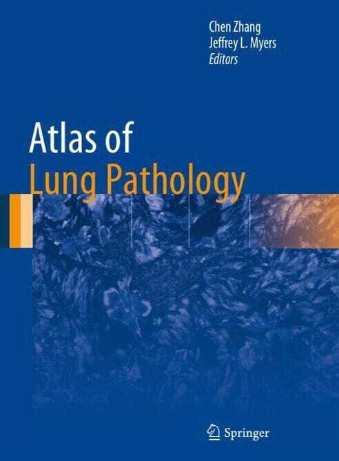 Atlas of Lung Pathology (Atlas of Anatomic Pathology)
1st ed. 2018 Edition