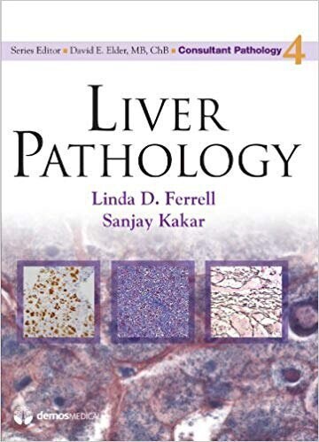 Liver Pathology (Consultant Pathology, Volume 4)
1st Edition