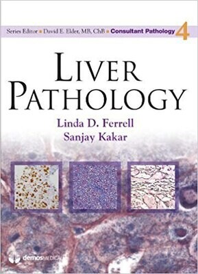 Liver Pathology (Consultant Pathology, Volume 4)
1st Edition