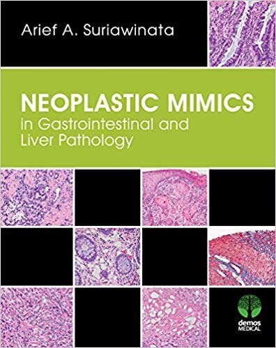 Neoplastic Mimics in Gastrointestinal and Liver Pathology (Pathology of Neoplastic Mimics)
1st Edition
