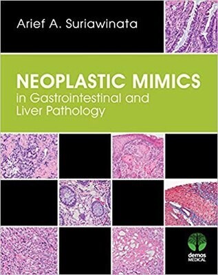 Neoplastic Mimics in Gastrointestinal and Liver Pathology (Pathology of Neoplastic Mimics)
1st Edition