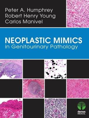 Neoplastic Mimics in Genitourinary Pathology (Pathology of Neoplastic Mimics)
1st Edition