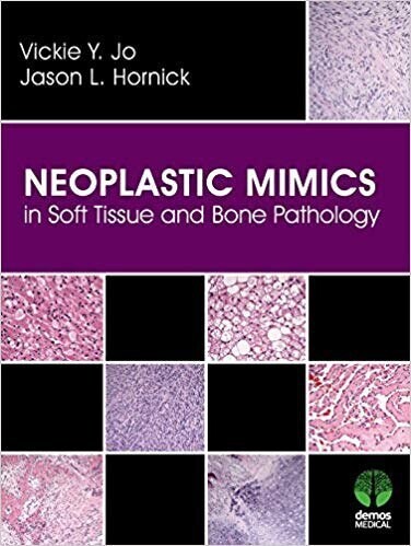 Neoplastic Mimics in Soft Tissue and Bone Pathology (Pathology of Neoplastic Mimics)
1st Edition