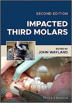 Impacted Third Molars, 2nd Edition