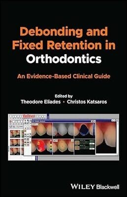 Debonding and Fixed Retention in Orthodontics: An Evidence-Based Clinical Guide 1st Edition