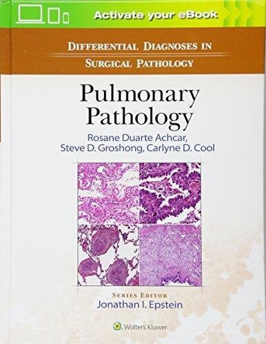 Differential Diagnoses in Surgical Pathology: Pulmonary Pathology
First Edition Edition