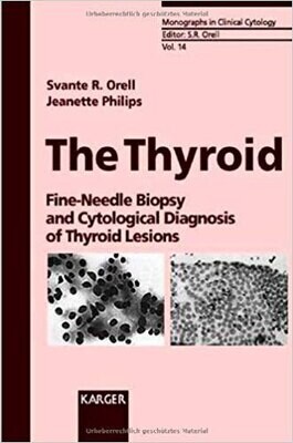 The Thyroid: Fine-Needle Biopsy and Cytological Diagnosis of Thyroid Lesions (MONOGRAPHS IN CLINICAL CYTOLOGY)
1st Edition
