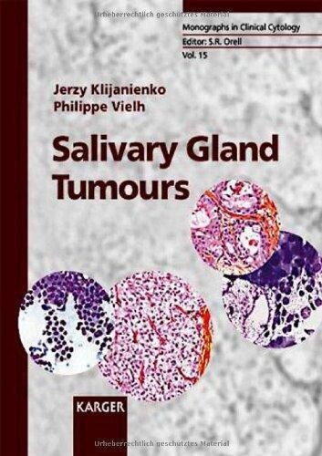 Salivary Gland Tumours: Monographs in Clinical Cytology
1st Edition