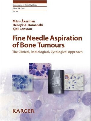 Fine Needle Aspiration of Bone Tumours: The Clinical, Radiological, Cytological Approach (Monographs in Clinical Cytology)
1st Edition