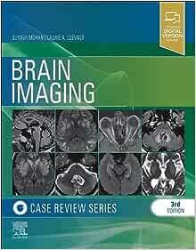 Brain Imaging: Case Review Series, 3rd edition