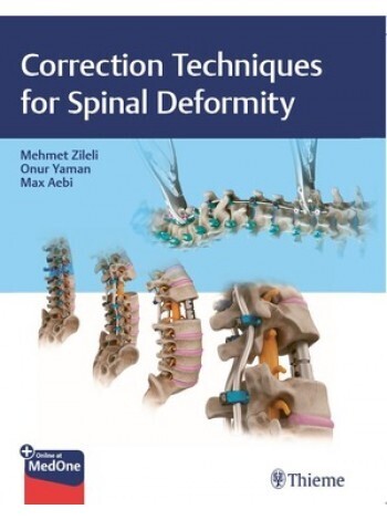 Correction Techniques for Spinal Deformity