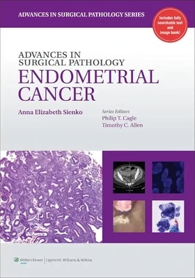 Advances in Surgical Pathology: Endometrial Cancer