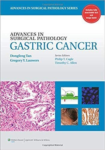 Gastric Cancer (Advances in Surgical Pathology)
1st Edition
