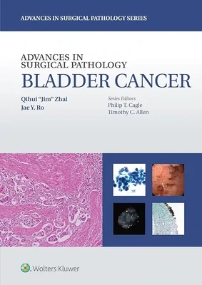 Advances in Surgical Pathology: Bladder Cancer
First Edition Edition