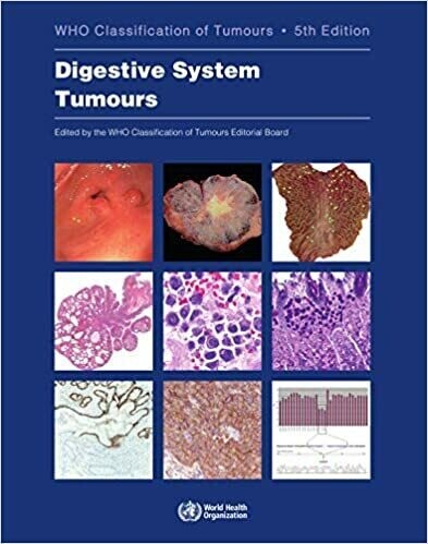 Digestive System Tumours: WHO Classification of Tumours (Medicine)
5th Edition