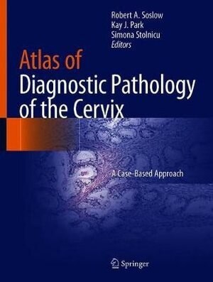 Atlas of Diagnostic Pathology of the Cervix: A Case-Based Approach
1st ed. 2021 Edition
