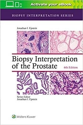 Biopsy Interpretation of the Prostate (Biopsy Interpretation Series) 6th Edition