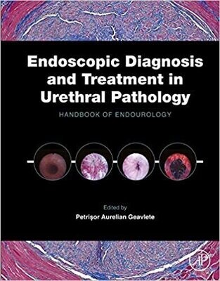 Endoscopic Diagnosis and Treatment in Urethral Pathology: Handbook of Endourology
1st Edition