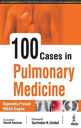 100 cases in Pulmonary Medicine