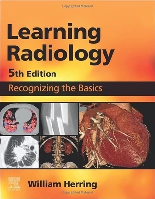 Learning Radiology: Recognizing the Basics
5th Edition