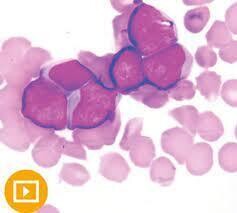 Current Concepts in Hematopathology 2022 Video Lectures